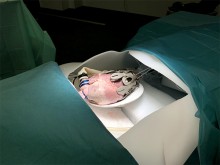 Exosquelette placé sur un cœur porcin explanté et mis en situation dans le simulateur EXOHEART conçu par l'équipe projet