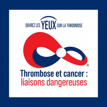 Thrombose et cancer : liaisons dangereuses