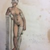 Fig. 4. Pierre Jacques Feillet, Application de bandages (P.-N. Gerdy, Traité des bandages..., Paris, 1837, Atlas)